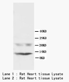 Phospholamban/PLN Rabbit Polyclonal Antibody