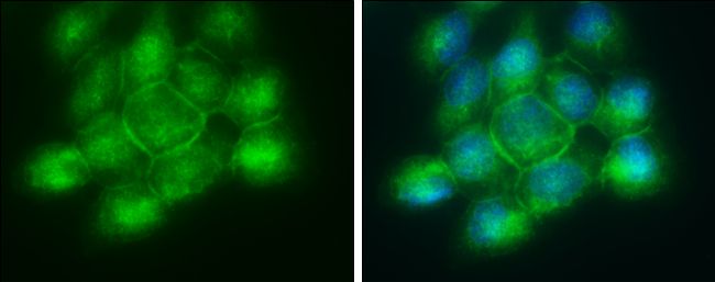 phospholipid scramblase 1 Antibody
