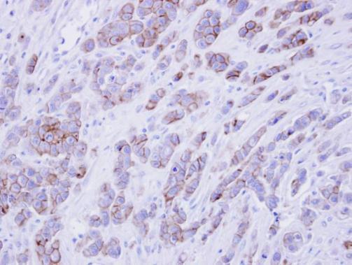 phospholipid scramblase 1 Antibody