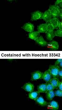 phospholipid scramblase 1 antibody
