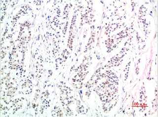 Phospho-SMAD3(S425) Antibody