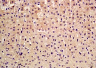 PHOX2A Rabbit Polyclonal Antibody