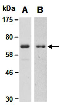 PIAS1 (C) Antibody, Mouse Monoclonal