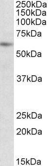 PIAS2 (aa185-196) Antibody
