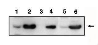 Rabbit Human PIG3 (p53 inducible gene 3) Antibody