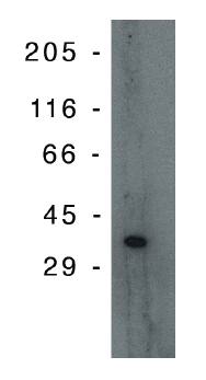 Mouse Human PIG3 (p53 inducible gene 3) Antibody
