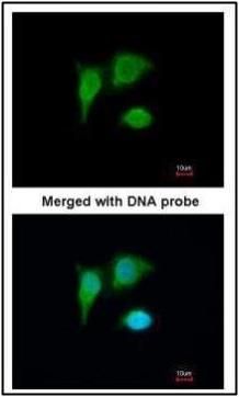tumor protein p53 inducible protein 3 Antibody