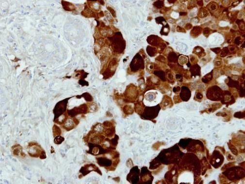 tumor protein p53 inducible protein 3 Antibody