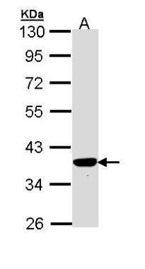 tumor protein p53 inducible protein 3 Antibody