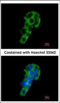 polymeric immunoglobulin receptor Antibody