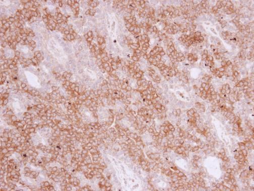 polymeric immunoglobulin receptor Antibody