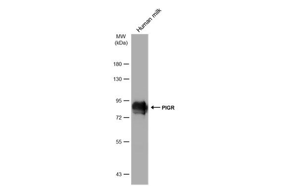 polymeric immunoglobulin receptor Antibody