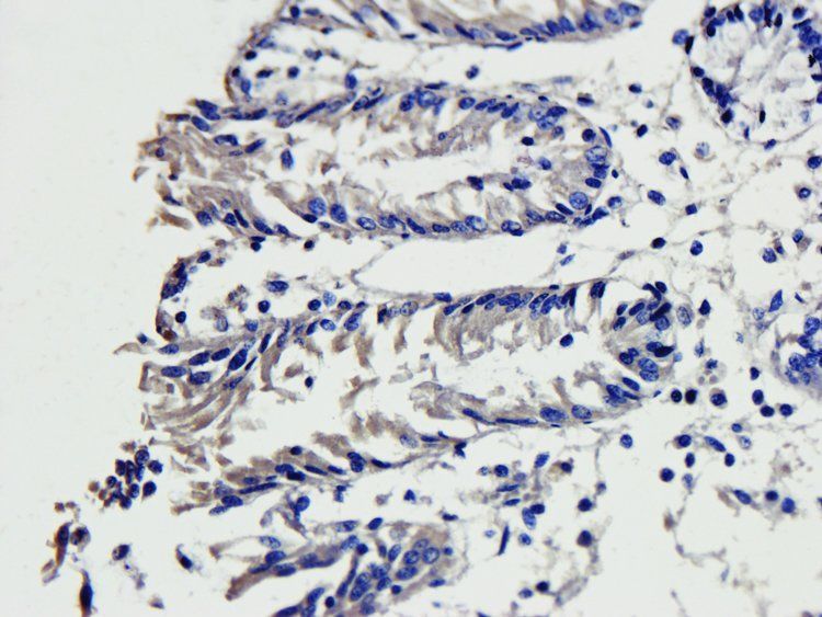 PIGR Rabbit Polyclonal Antibody