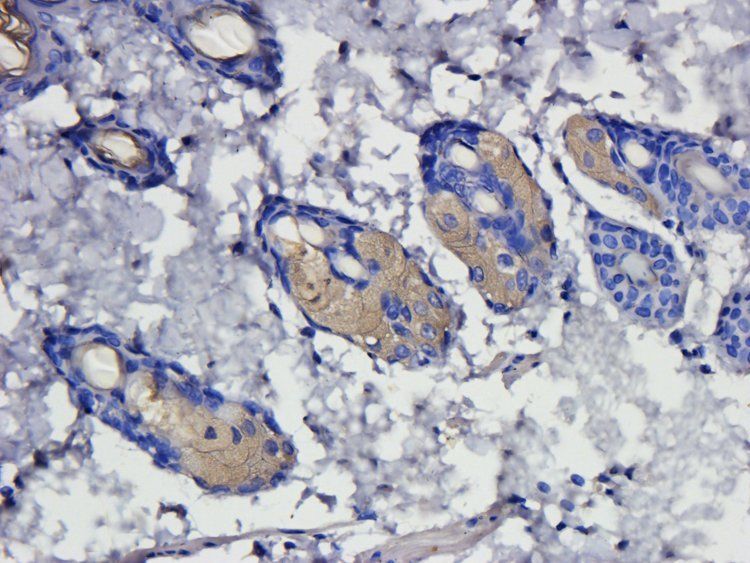 PIGR Rabbit Polyclonal Antibody