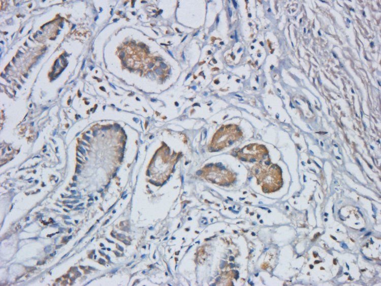PIGR Rabbit Polyclonal Antibody