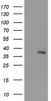 PIH1D2 Antibody