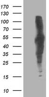 PIH1D2 Antibody