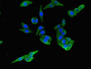 PIH1D3 Antibody