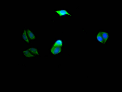 PIK3CA Antibody