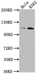 PIK3CB Antibody