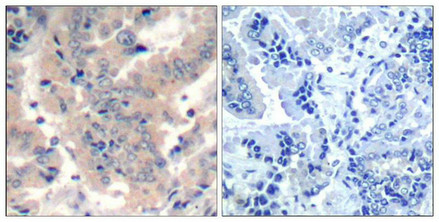 PIK3R1/PIK3R3 Antibody