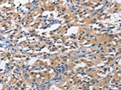 PIM1 Antibody