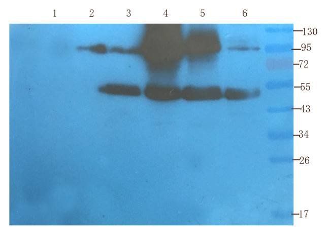 PIM1 Rabbit Polyclonal Antibody