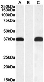 PIM2 (aa23-36) Antibody
