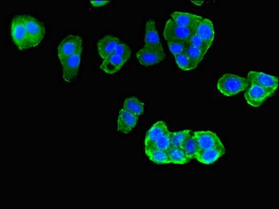 PIM3 Antibody