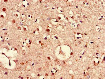 PIM3 Antibody