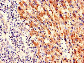 PIM3 Antibody
