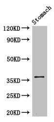 PIM3 Antibody