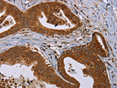 PIM3 Antibody