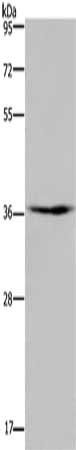 PIM3 Antibody