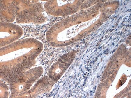 Rabbit Human PINK1 (C-Terminal) Antibody