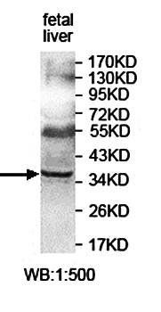 PINX1 Rabbit Polyclonal Antibody