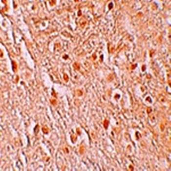 PION Antibody