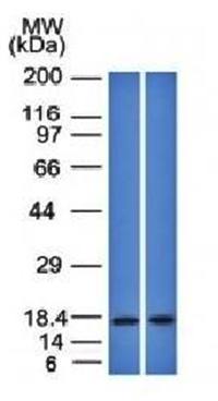 PIP Antibody