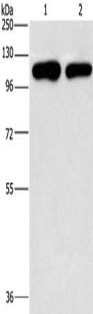 PIP5K1C Antibody