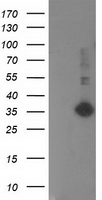 PIP4K2A Antibody