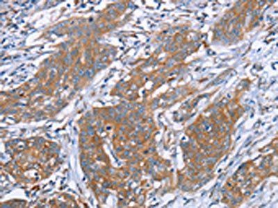 PITPNM1 Antibody