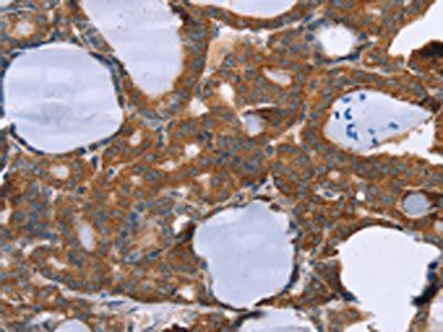 PITPNM1 Antibody