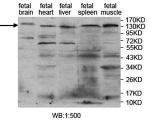 PITPNM2 Rabbit Polyclonal Antibody