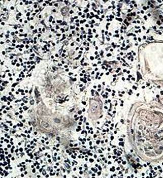 PITPNM2 Rabbit Polyclonal Antibody