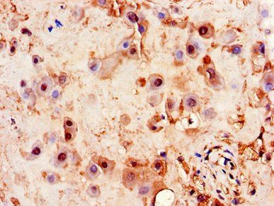 PITX3 Antibody