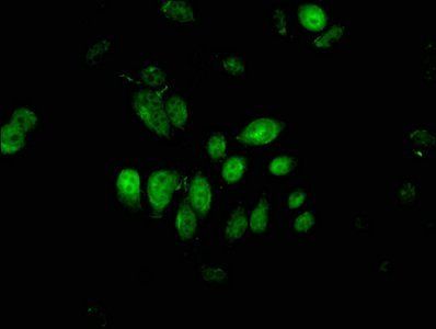PIWIL4 Antibody