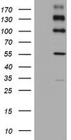 PKC zeta Antibody