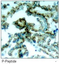 PKCβ (Phospho-Thr641) Antibody
