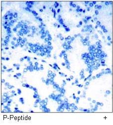 PKCβ (Phospho-Thr641) Antibody