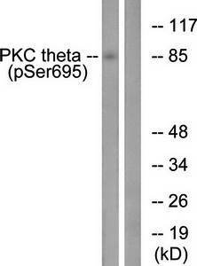 PKC θ (Phospho-Ser695) Antibody
